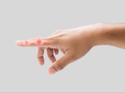 Đau các khớp ngón tay – chớ xem nhẹ dấu hiệu âm thầm