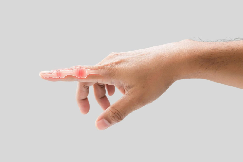 Đau các khớp ngón tay – chớ xem nhẹ dấu hiệu âm thầm