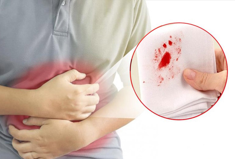 Đau dạ dày nôn ra máu: Tín hiệu nguy hiểm chớ coi thường