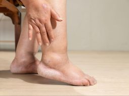 Đau khớp cổ chân kéo dài – đừng để thành tật lâu năm