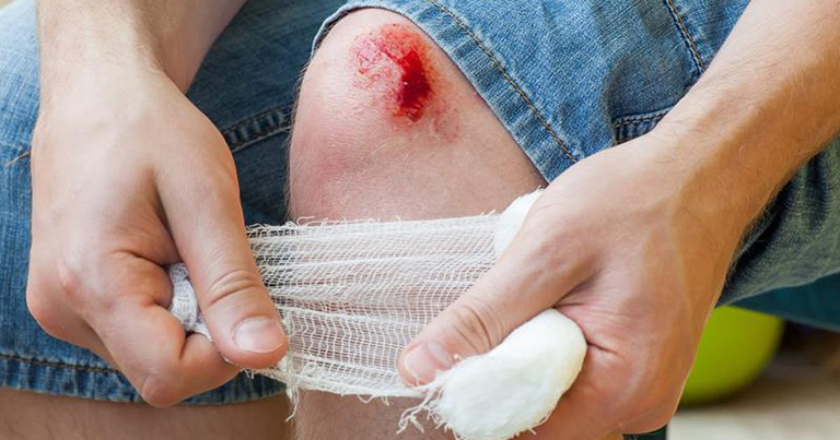 Triệu Chứng Nổi Mẩn Ngứa Xung Quanh Vết Thương: Nguyên Nhân Và Giải Pháp Đông Y