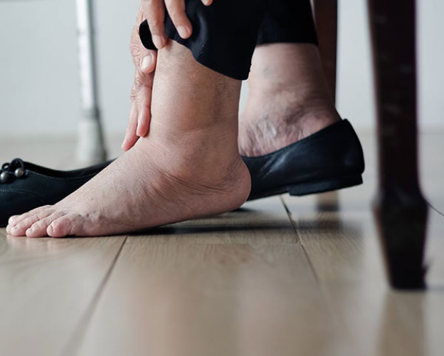 Tràn dịch khớp cổ chân bao lâu thì khỏi? Nghe Lão Tuấn giãi bày