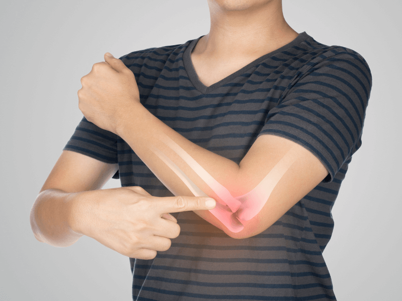 Trật khớp khuỷu tay bao lâu thì khỏi? Góc nhìn từ Lão Tuấn