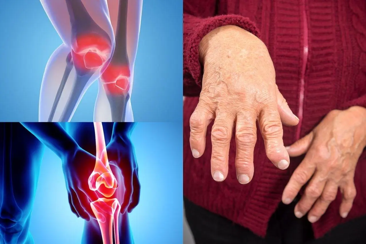 Thoái hóa khớp và viêm khớp khác nhau thế nào?