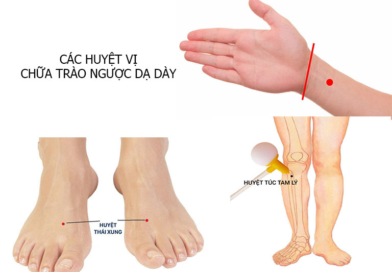 Trào ngược dạ dày bấm huyệt nào để xoa dịu từ gốc?
