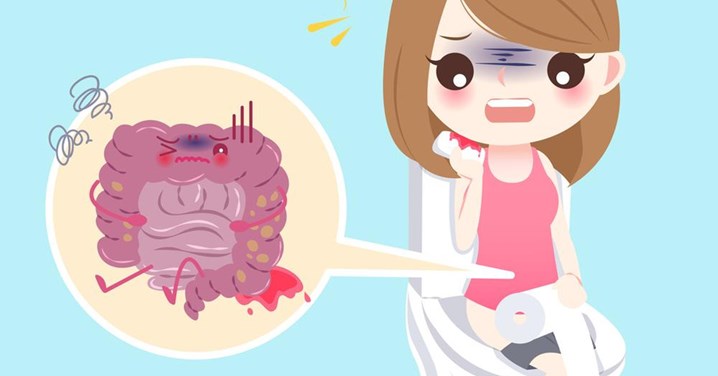 Dấu hiệu xuất huyết tiêu hóa: Đừng để "vong huyết" mới tìm thầy