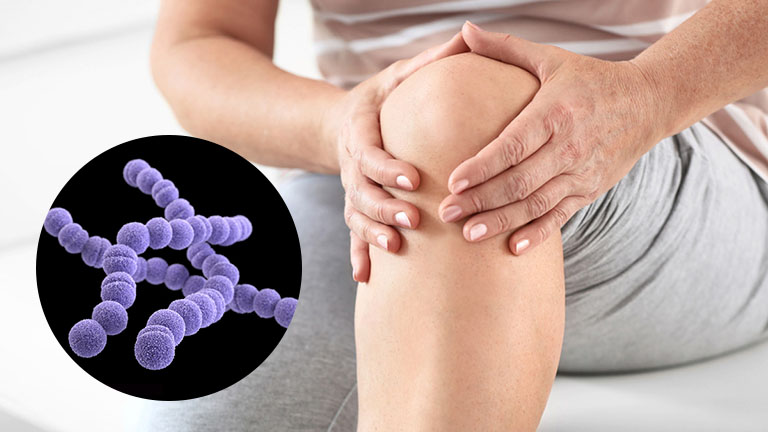 Cảnh giác với tác nhân gây viêm khớp phản ứng: Đừng để "nội tặc" phá nát khung xương