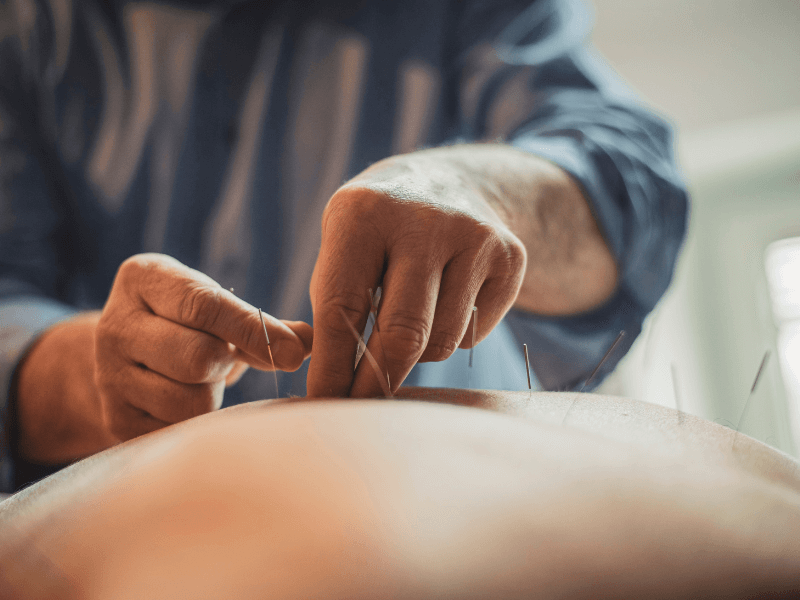 Châm cứu giảm đau khớp: Cùng Lão tìm về gốc rễ để thông kinh hoạt lạc