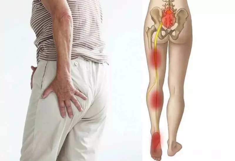 Đau thắt lưng lan xuống chân: Cảnh báo thoát vị đĩa đệm và cách trị từ gốc