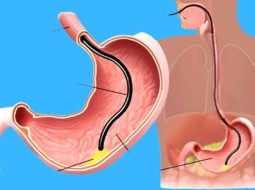 Viêm xung huyết hang vị chữa mãi không khỏi? Lão Tuấn tư vấn