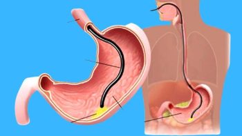 Viêm xung huyết hang vị chữa mãi không khỏi? Lão Tuấn tư vấn