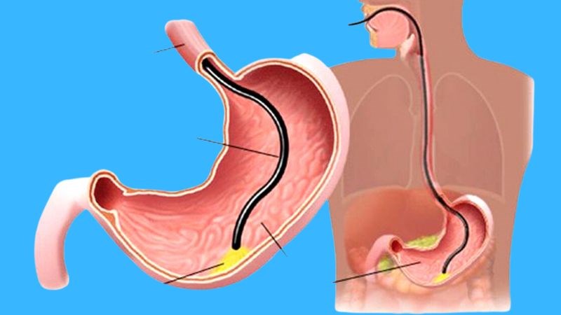 Viêm xung huyết hang vị chữa mãi không khỏi? Lão Tuấn tư vấn
