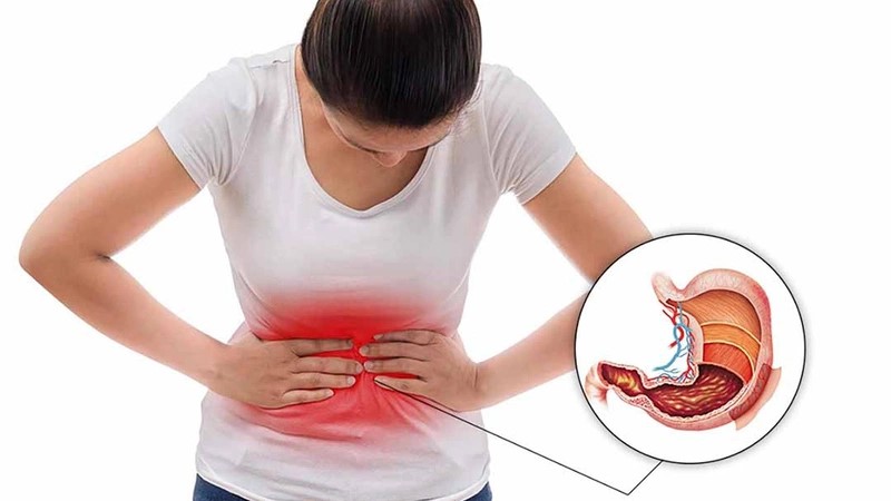 Triệu chứng viêm dạ dày bà con chớ coi thường kẻo hối không kịp