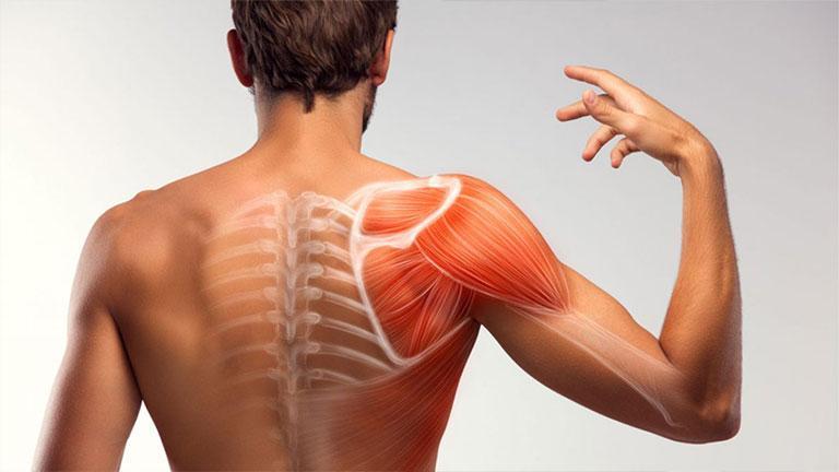 Điều trị viêm khớp vai: Chớ lạm dụng tiêm giảm đau kẻo gân khô, khớp dính