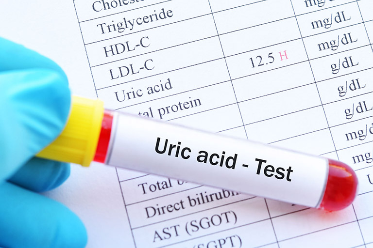 Chỉ số acid uric bao nhiêu thì bị Gout? Lời dặn từ Lão Tuấn để bà con chủ động phòng thân