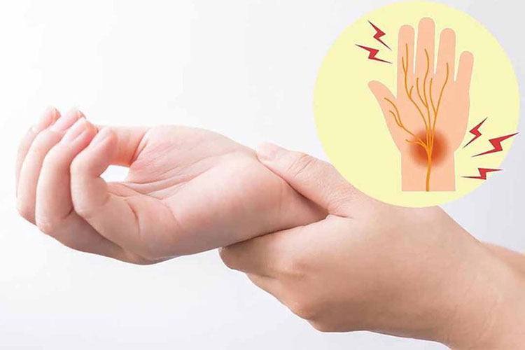 Đau cổ tay đến ngón tay: Cẩn trọng hội chứng chèn ép kinh mạch