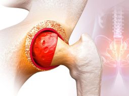 Đau khớp cùng chậu mãn tính có chữa được không và lời dặn từ Lão Tuấn