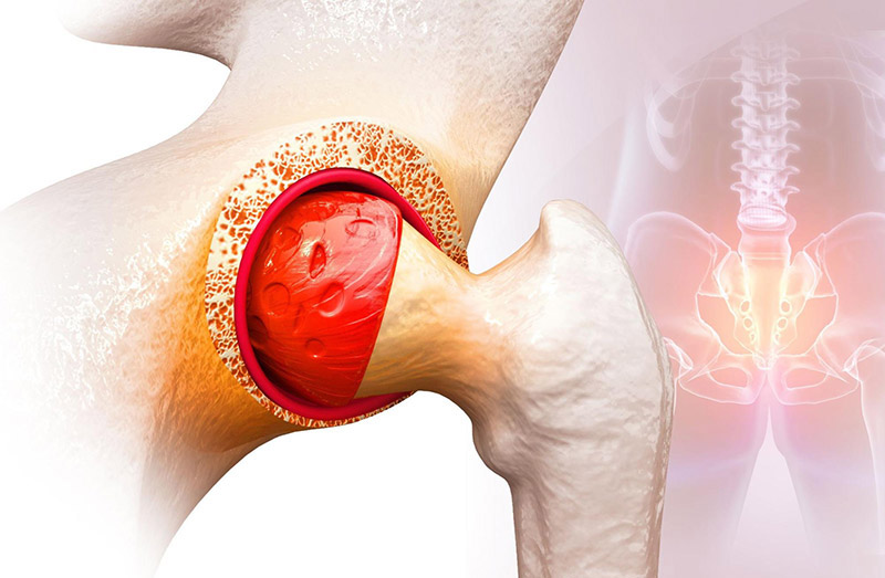 Đau khớp cùng chậu mãn tính có chữa được không và lời dặn từ Lão Tuấn