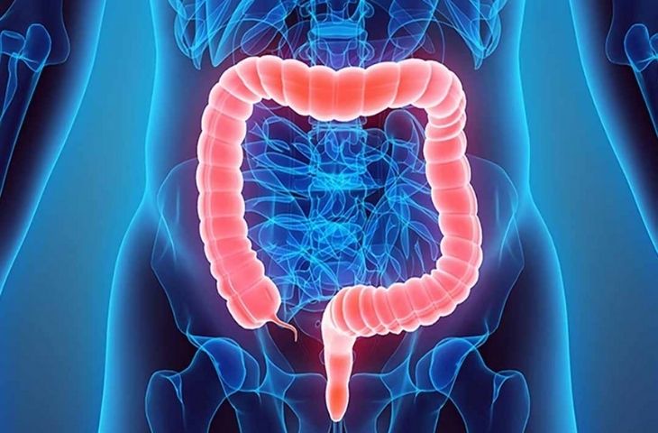 Điều trị hội chứng ruột kích thích: Hết đau chướng, ổn định tiêu hóa