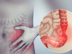 Viêm đại tràng mãn tính: Hậu quả khó lường và cách trị từ gốc