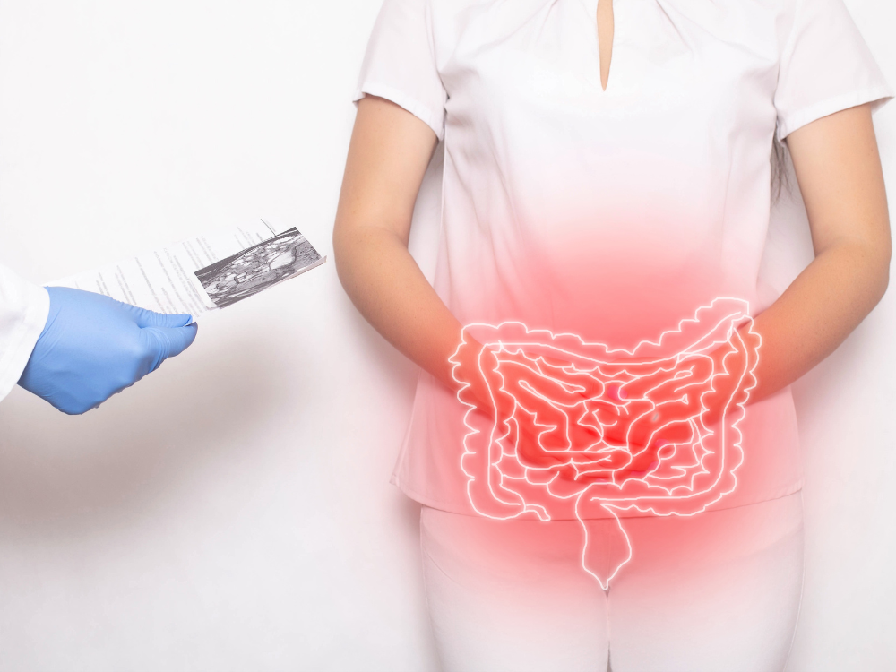 Hội chứng ruột kích thích có nguy hiểm không và cách chữa từ gốc