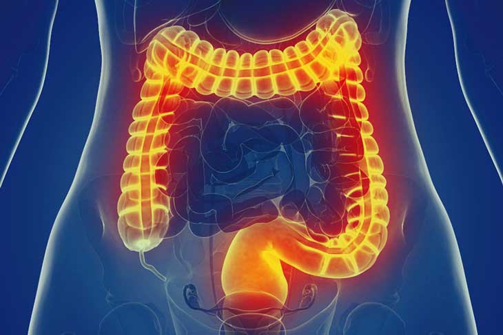 Hội chứng ruột kích thích có nguy hiểm không? Lời khuyên từ Lão Tuấn