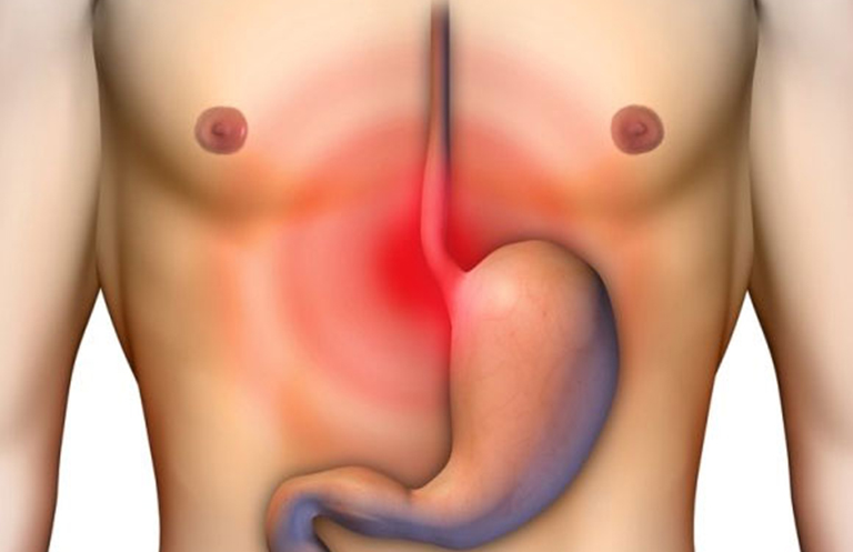 Triệu chứng viêm thực quản và cách trị tận gốc theo y lý Lão Tuấn