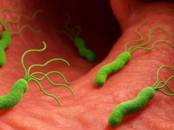 Vi khuẩn HP dạ dày: Hiểu đúng để không còn lo sợ ung thư