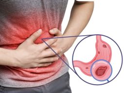 Rối loạn tiêu hóa do viêm loét dạ dày tá tràng: Trị từ gốc mới an