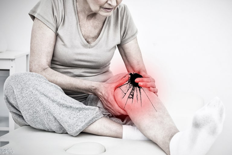 Điều trị thoái hóa khớp gối ở người cao tuổi: Chữa từ gốc để gối khỏe, chân vui