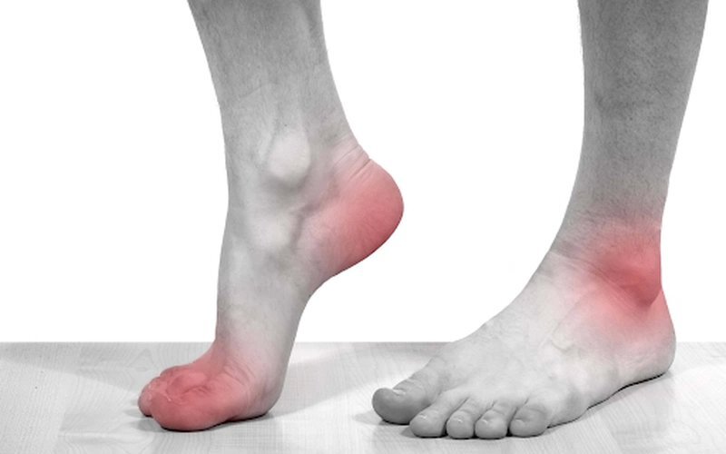 Viêm đa khớp dạng thấp có chữa khỏi được không và lời khuyên từ Lão Tuấn