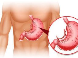 Viêm xung huyết hang vị có khỏi không? Lời dặn từ Lão Tuấn