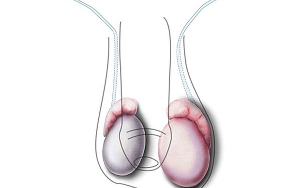 Tinh hoàn nhỏ có tinh trùng không? Lời giải từ Lão Tuấn