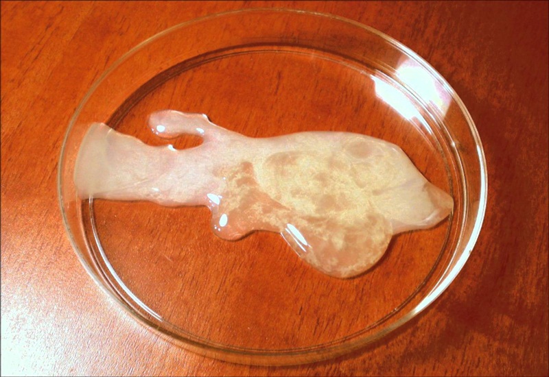 Vì sao tinh trùng loãng? Lời dặn từ Lão Tuấn để giữ gốc Thận sung mãn