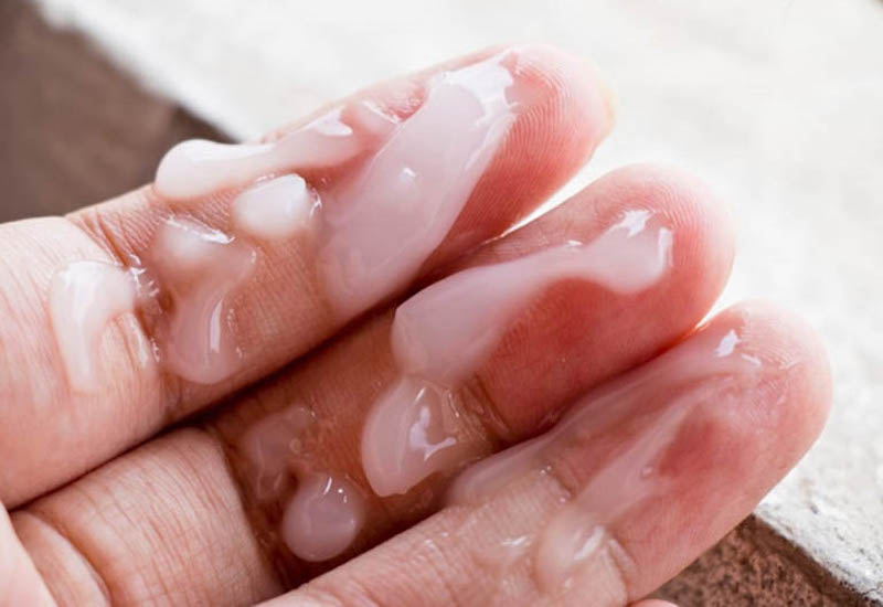 Tinh trùng đặc là gì? Cách lấy lại phong độ quý ông từ gốc Thận