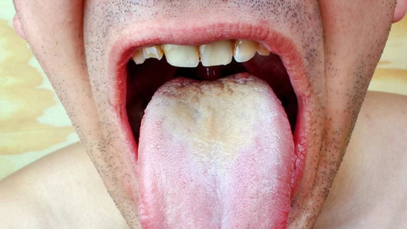 Nhìn lưỡi biết thận hư: Bí quyết soi tỏ sinh lực phái mạnh của Lão Tuấn