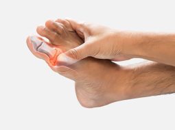 Bệnh gút có ảnh hưởng đến tinh trùng? Lời cảnh báo cho Anh Em