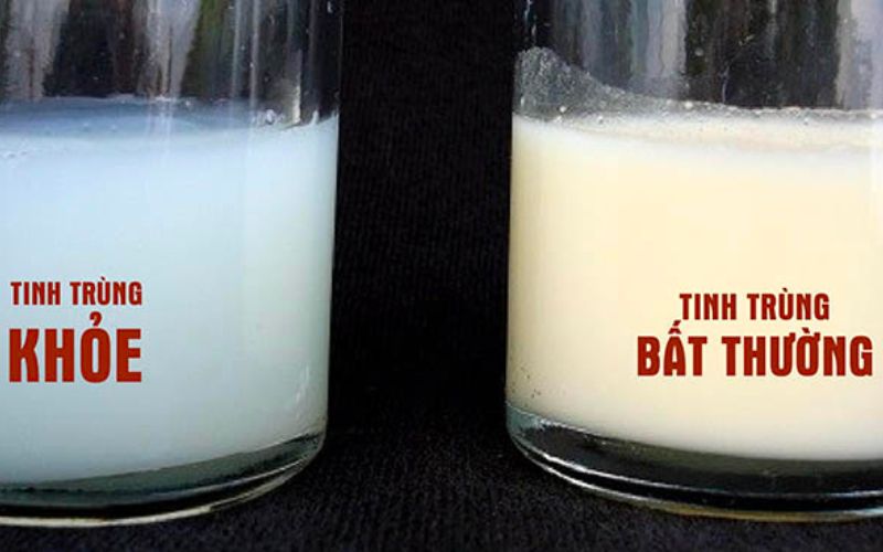 Tinh trùng bình thường là gì? Bí quyết giữ vững bản lĩnh của Lão Tuấn