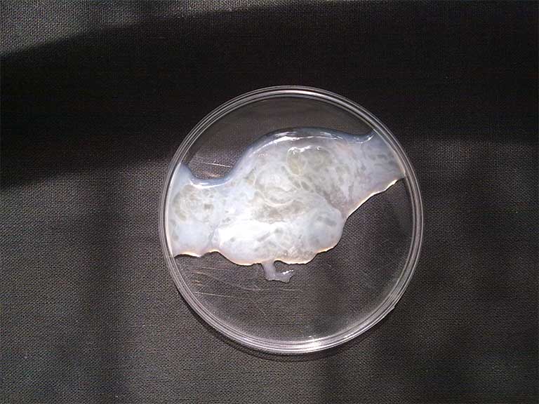 Cách nhận biết tinh trùng vón cục và lời khuyên từ Lão Tuấn