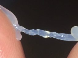 Cách điều trị tinh trùng vón cục: Bí quyết bổ Thận, vững bản lĩnh