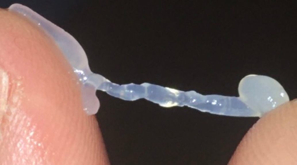 Cách điều trị tinh trùng vón cục: Bí quyết bổ Thận, vững bản lĩnh