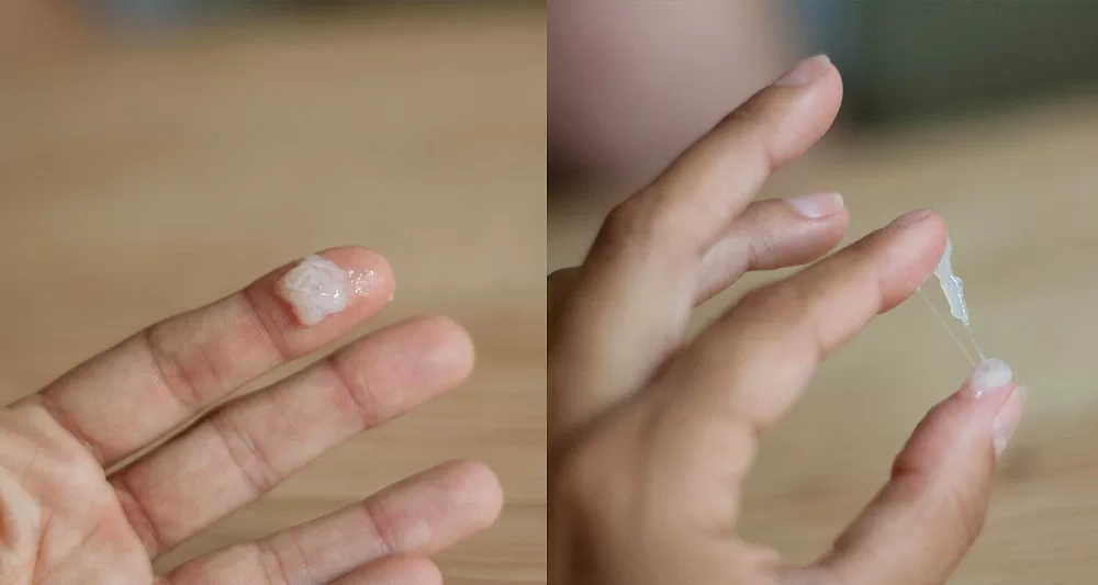 Tinh trùng quá đặc là bệnh gì? Lời khuyên giúp Anh Em sớm cải thiện