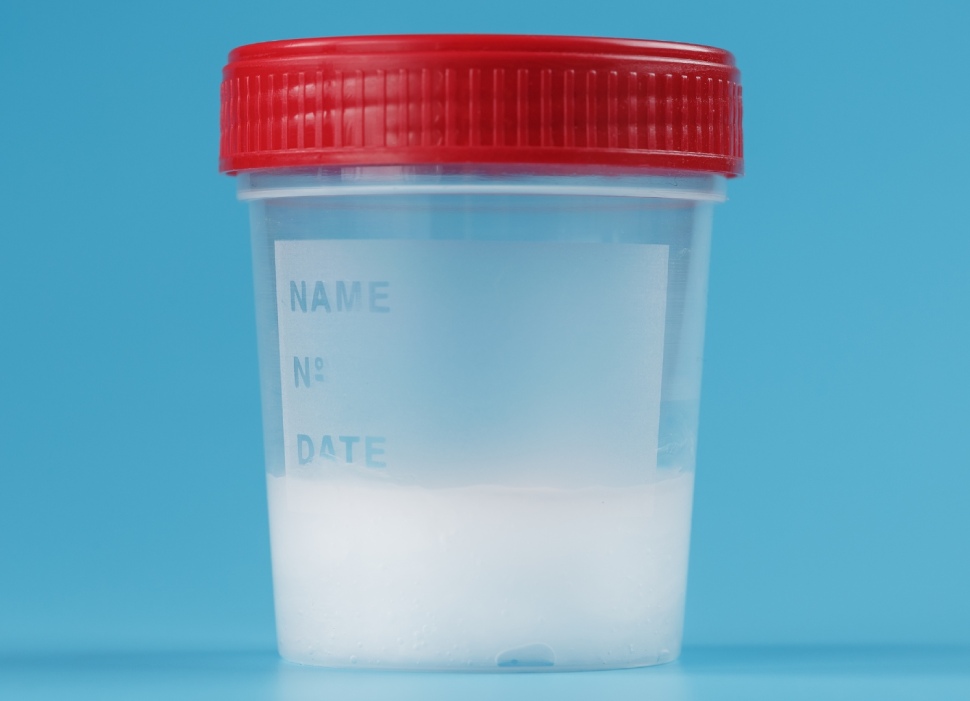 5 Dấu Hiệu Tinh Trùng Khỏe Mạnh Anh Em Cần Biết Để Sớm Có Tin Vui