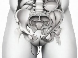 Rối loạn cương dương nguyên phát: Lấy lại bản lĩnh từ gốc thận khí