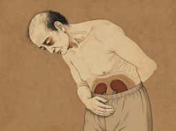 Thận khí hao tổn do lao lực: Cảnh báo nguy cơ kiệt quệ bản lĩnh nam nhi