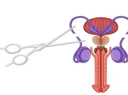 Thắt ống dẫn tinh thì tinh trùng đi đâu? Lời giải đáp từ Lão Tuấn