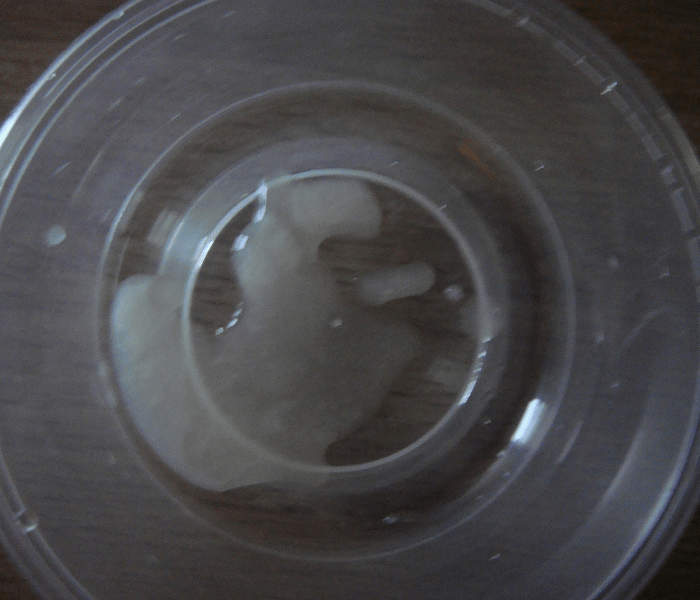 Tinh trùng loãng và ít: Cách bồi bổ từ gốc để vượng tinh, bền sức