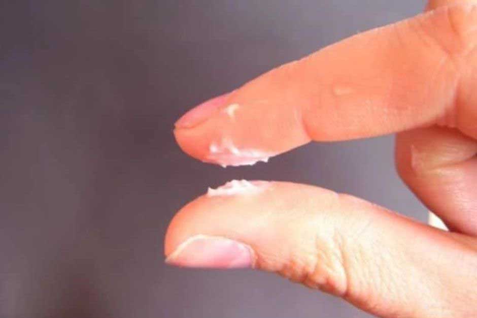 Tinh trùng vón cục như hạt gạo: Dấu hiệu thận yếu chớ coi thường!