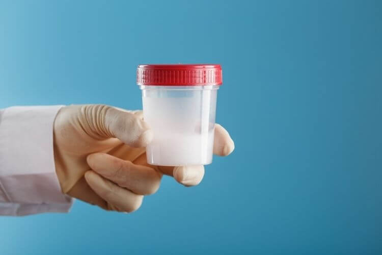 Tinh trùng vón cục màu trắng: Đừng chủ quan kẻo hỏng "hạt giống"