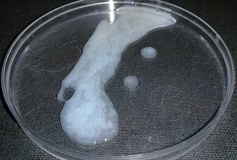 Tinh trùng có màu gì là bình thường? Dấu hiệu cảnh báo bệnh lý